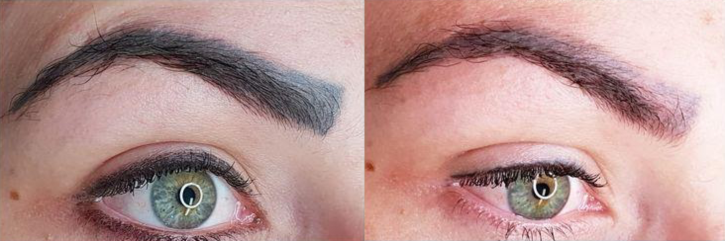 Voor (links) en na (rechts) foto's van de Swiss Color x Remove behandeling